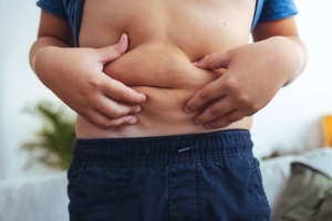 Childhood Obesity Overtakes Underweight